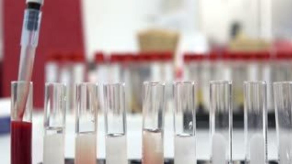La sérologie du coronavirus SRAS-CoV-2 responsable du Covid